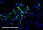 VPS35 Antibody in Immunohistochemistry (IHC)