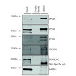 VPS35 Antibody in Immunoprecipitation (IP)