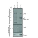 VPS35 Antibody in Immunoprecipitation (IP)