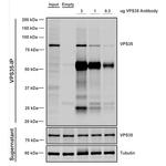 VPS35 Antibody in Immunoprecipitation (IP)