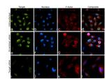 JMJD1B Antibody in Immunocytochemistry (ICC/IF)