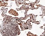 SETD1A Antibody in Immunohistochemistry (Paraffin) (IHC (P))