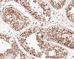 SETD1A Antibody in Immunohistochemistry (Paraffin) (IHC (P))