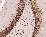 SETD1A Antibody in Immunohistochemistry (Paraffin) (IHC (P))