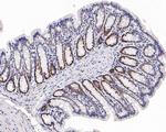 EZH1 Antibody in Immunohistochemistry (Paraffin) (IHC (P))