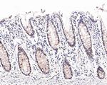 EZH1 Antibody in Immunohistochemistry (Paraffin) (IHC (P))