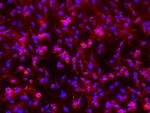 CD146 Antibody in Immunocytochemistry (ICC/IF)