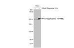 Phospho-ATR (Thr1989) Antibody in Western Blot (WB)