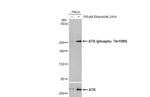 Phospho-ATR (Thr1989) Antibody in Western Blot (WB)