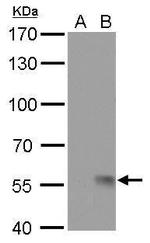 Influenza A H1N1 NA (A/WSN/1933) Antibody in Western Blot (WB)