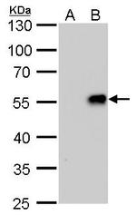 Influenza A H1N1 NA (A/WSN/1933) Antibody in Western Blot (WB)