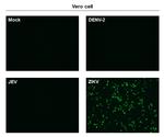 Zika Virus NS1 (strain H/PF/2013) Antibody in Immunocytochemistry (ICC/IF)