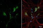 C9orf72 Antibody in Immunocytochemistry (ICC/IF)