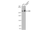 ATM Antibody in Western Blot (WB)