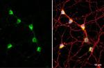 C9orf72 Antibody in Immunocytochemistry (ICC/IF)