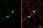 C9orf72 Antibody in Immunocytochemistry (ICC/IF)