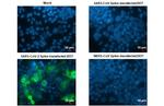 SARS-CoV-2 Spike Protein RBD (strain Wuhan-Hu-1) Antibody in Immunocytochemistry (ICC/IF)