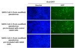 SARS-CoV-2 Spike Protein RBD (strain Wuhan-Hu-1) Antibody in Neutralization (Neu)