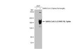 SARS-CoV-2 Spike Protein S2 Antibody in Western Blot (WB)