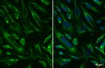 SDHA Antibody in Immunocytochemistry (ICC/IF)