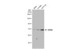 SDHA Antibody in Western Blot (WB)