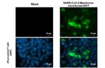 SARS-CoV-2 Membrane Antibody in Immunocytochemistry (ICC/IF)