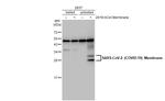 SARS-CoV-2 Membrane Antibody in Western Blot (WB)