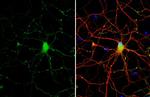 Somatostatin Antibody in Immunocytochemistry (ICC/IF)