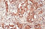 SQSTM1 Antibody in Immunohistochemistry (Paraffin) (IHC (P))