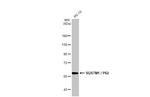 SQSTM1 Antibody in Western Blot (WB)