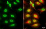 SMARCA2 Antibody in Immunocytochemistry (ICC/IF)