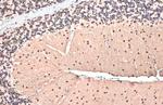 SMARCA2 Antibody in Immunohistochemistry (Paraffin) (IHC (P))