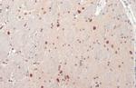 SMARCA2 Antibody in Immunohistochemistry (Paraffin) (IHC (P))