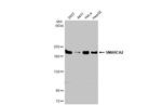 SMARCA2 Antibody in Western Blot (WB)