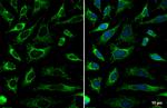 SDHA Antibody in Immunocytochemistry (ICC/IF)