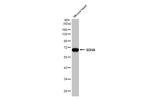 SDHA Antibody in Western Blot (WB)