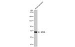 SDHA Antibody in Western Blot (WB)