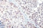 p53 (R175H Mutant) Antibody in Immunohistochemistry (Paraffin) (IHC (P))