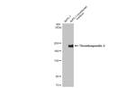 Thrombospondin 2 Antibody in Western Blot (WB)