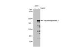 Thrombospondin 2 Antibody in Western Blot (WB)