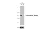 Glucocorticoid receptor (NR3C1) Antibody in Western Blot (WB)