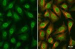 Glucocorticoid receptor (NR3C1) Antibody in Immunocytochemistry (ICC/IF)