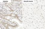 Glucocorticoid receptor (NR3C1) Antibody in Immunohistochemistry (Paraffin) (IHC (P))