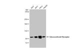 Glucocorticoid receptor (NR3C1) Antibody in Western Blot (WB)