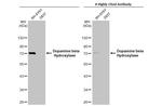 Dopamine beta Hydroxylase Antibody in Western Blot (WB)