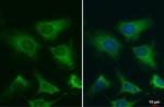 gamma Tubulin Antibody in Immunocytochemistry (ICC/IF)