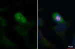 gamma Tubulin Antibody in Immunocytochemistry (ICC/IF)