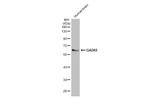 GAD65 Antibody in Western Blot (WB)