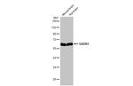 GAD65 Antibody in Western Blot (WB)