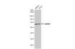 GAD65 Antibody in Western Blot (WB)